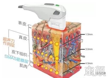https://img.miyanlife.com/mnt/timg/200229/142521K40-5.jpg