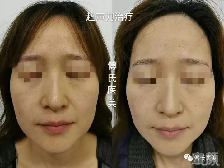 https://img.miyanlife.com/mnt/timg/200229/1425263S4-13.jpg