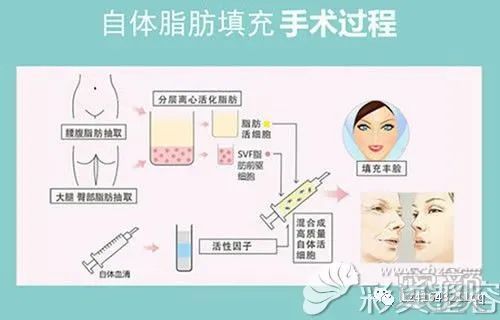 https://img.miyanlife.com/mnt/timg/200301/1229235054-1.jpg