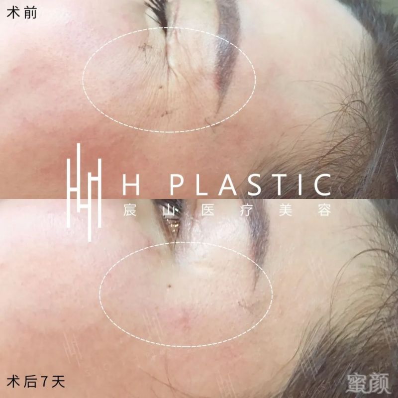 https://img.miyanlife.com/mnt/timg/200301/1345153058-3.jpg
