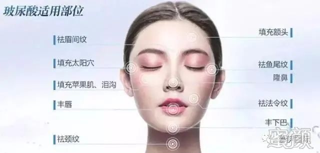 https://img.miyanlife.com/mnt/timg/200302/130QQ249-2.jpg