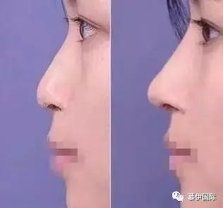 https://img.miyanlife.com/mnt/timg/200302/130QQ402-3.jpg