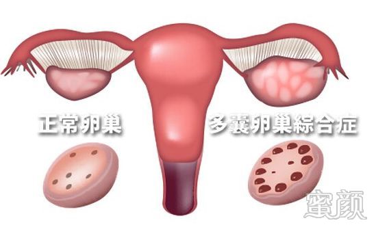 https://img.miyanlife.com/mnt/timg/200303/134453K19-0.jpg