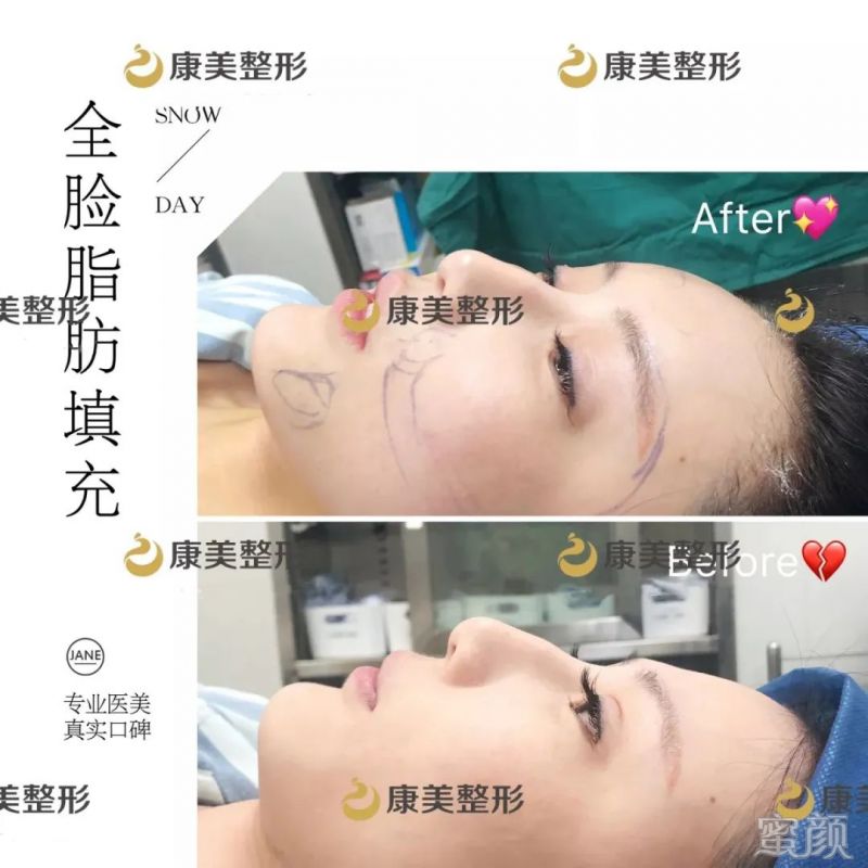 https://img.miyanlife.com/mnt/timg/200303/141JW1S-2.jpg