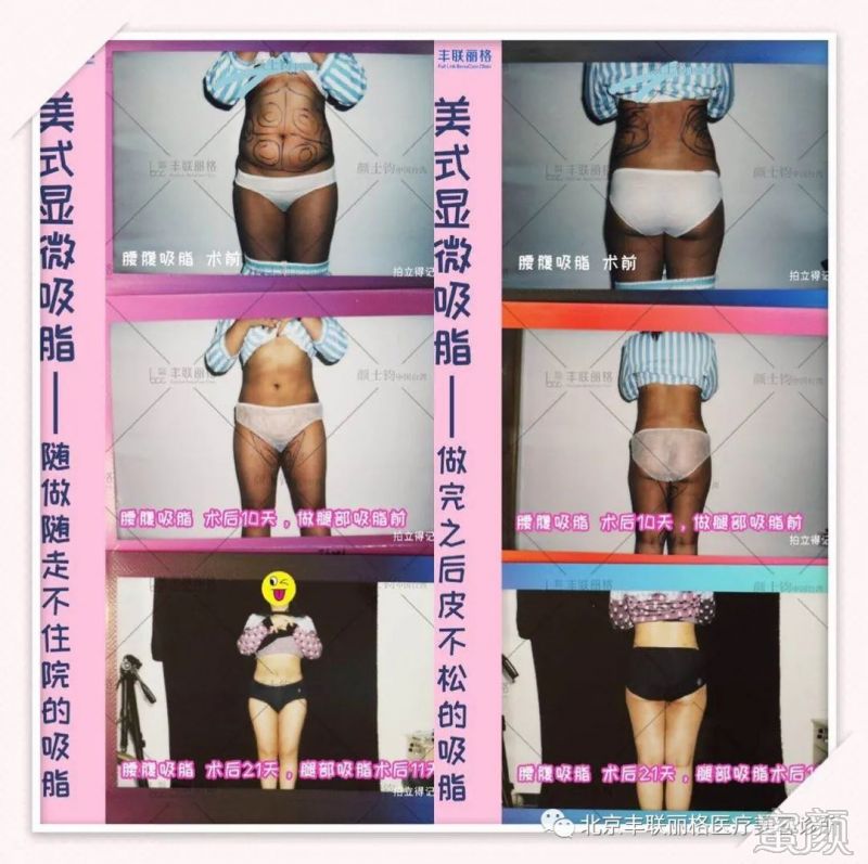 https://img.miyanlife.com/mnt/timg/200304/1414522538-3.jpg