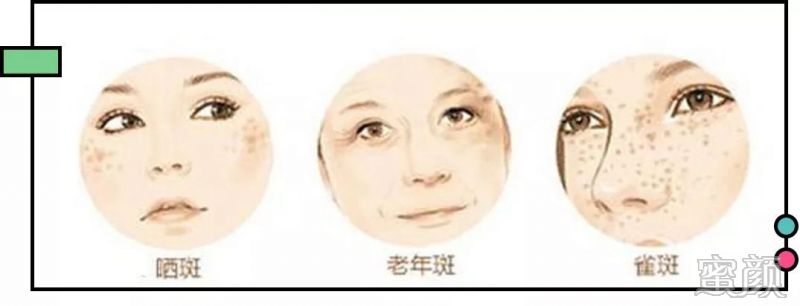 https://img.miyanlife.com/mnt/timg/200304/14495U146-3.jpg