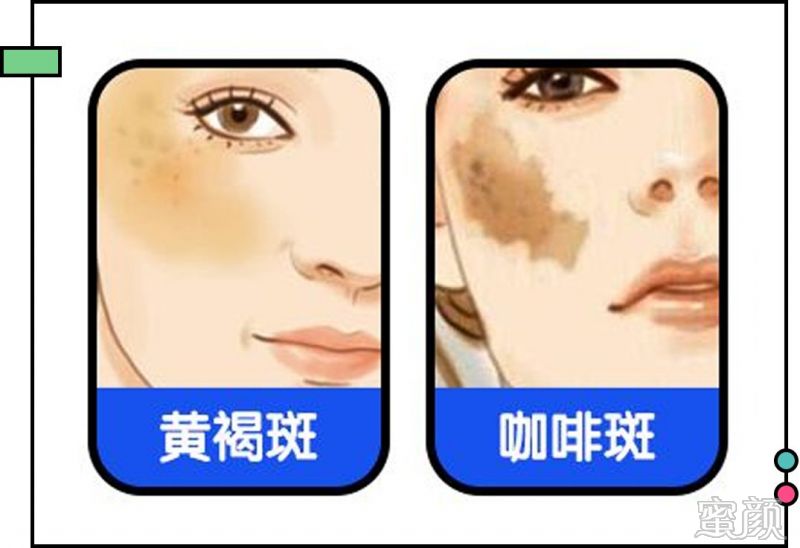 https://img.miyanlife.com/mnt/timg/200304/14495W426-5.jpg