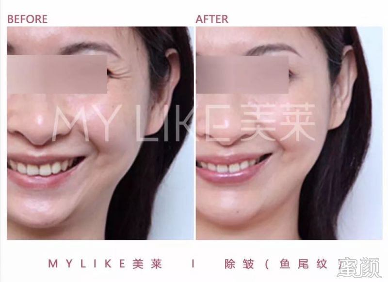 https://img.miyanlife.com/mnt/timg/200305/130545M10-5.jpg