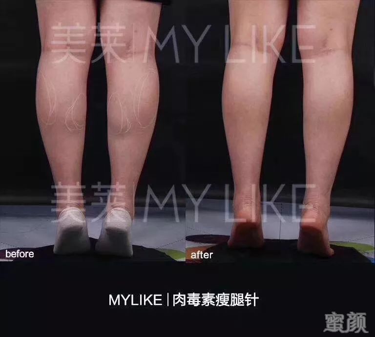 https://img.miyanlife.com/mnt/timg/200305/1305463621-6.jpg