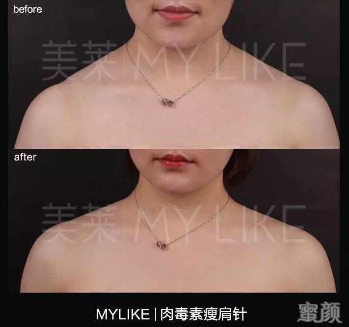 https://img.miyanlife.com/mnt/timg/200305/13054H5M-7.jpg