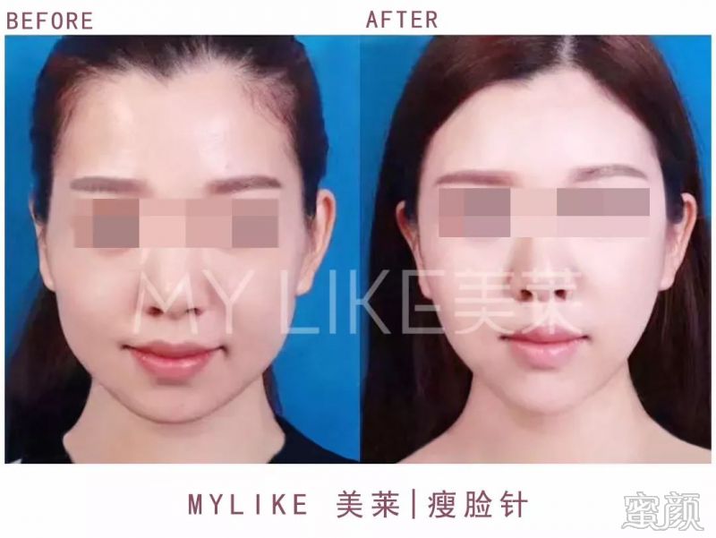 https://img.miyanlife.com/mnt/timg/200305/13054T5X-8.jpg