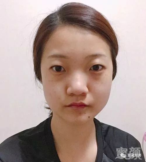 https://img.miyanlife.com/mnt/timg/200305/14194045Z-0.jpg
