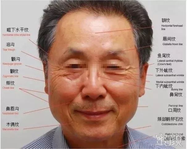 https://img.miyanlife.com/mnt/timg/200305/143S46305-1.jpg
