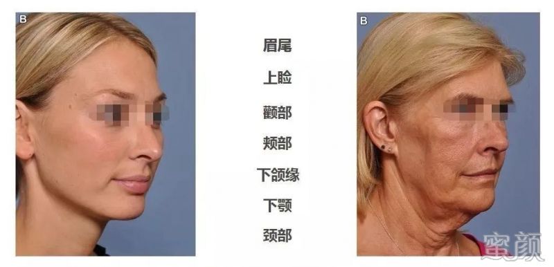 https://img.miyanlife.com/mnt/timg/200305/143S51228-2.jpg