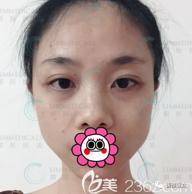 https://img.miyanlife.com/mnt/timg/200306/160K45T3-1.jpg