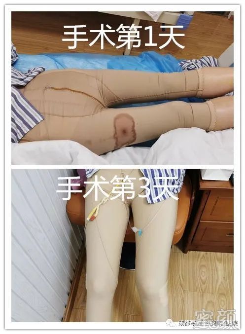 https://img.miyanlife.com/mnt/timg/200309/1254191507-6.jpg