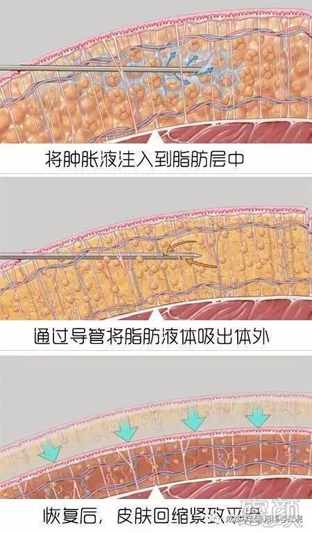 https://img.miyanlife.com/mnt/timg/200309/12541U113-4.jpg