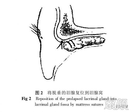 案例图片