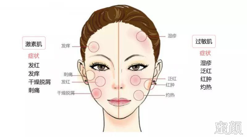 https://img.miyanlife.com/mnt/timg/200310/13150Q191-2.jpg