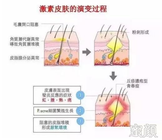 https://img.miyanlife.com/mnt/timg/200310/13150U410-1.jpg