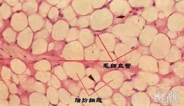 https://img.miyanlife.com/mnt/timg/200310/131F91200-2.jpg