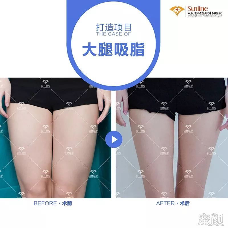 https://img.miyanlife.com/mnt/timg/200311/13145632A-5.jpg