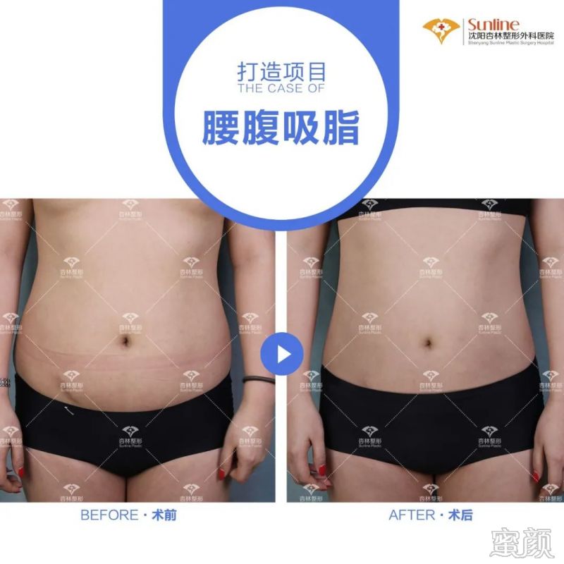 https://img.miyanlife.com/mnt/timg/200311/13145J591-6.jpg
