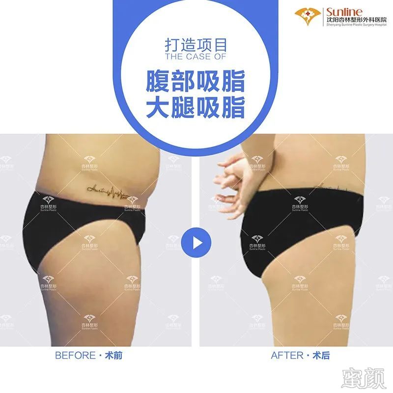 https://img.miyanlife.com/mnt/timg/200311/13145Q533-8.jpg
