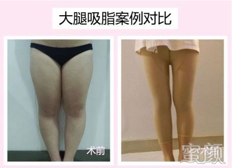 https://img.miyanlife.com/mnt/timg/200312/13443555T-1.jpg