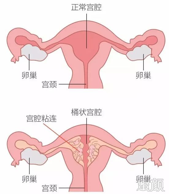 https://img.miyanlife.com/mnt/timg/200313/1241141H9-0.jpg