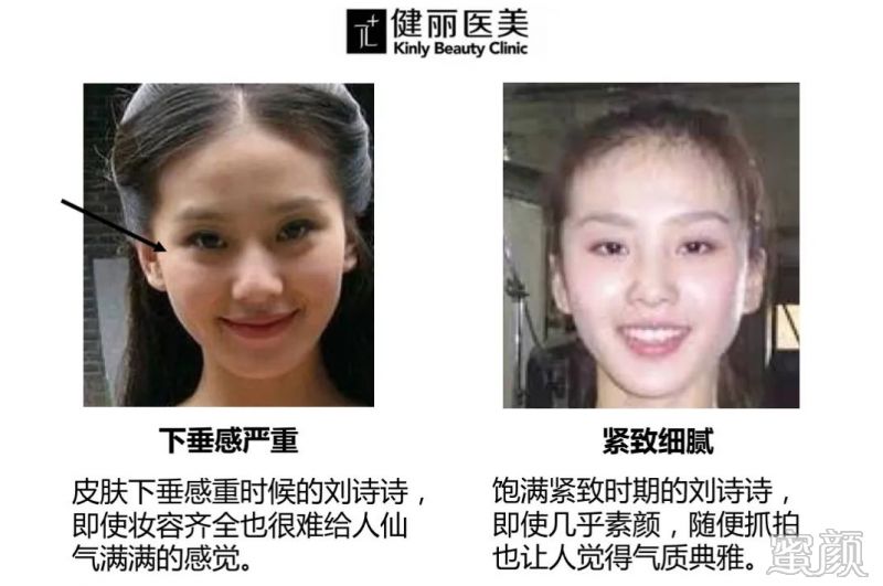 https://img.miyanlife.com/mnt/timg/200313/14015K5A-1.jpg