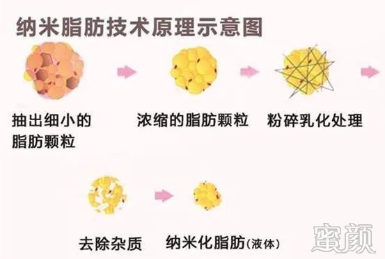 https://img.miyanlife.com/mnt/timg/200313/1420563130-4.jpg