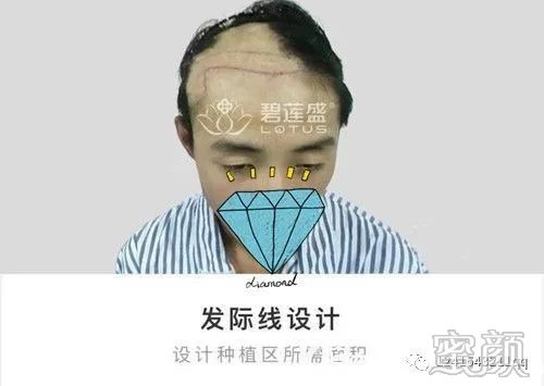 案例图片