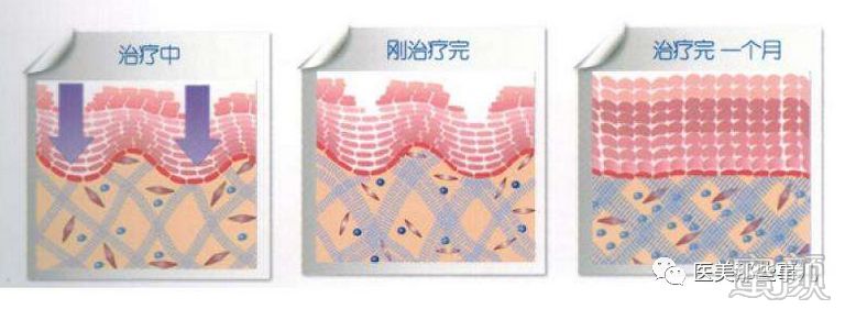 https://img.miyanlife.com/mnt/timg/200314/142T95b7-7.jpg