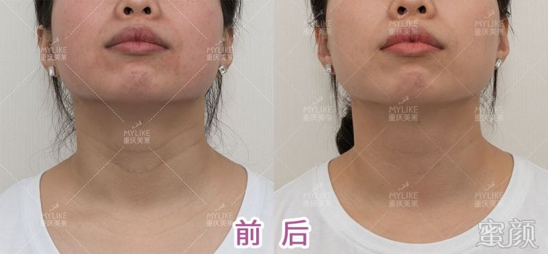 https://img.miyanlife.com/mnt/timg/200315/1504035352-9.jpg