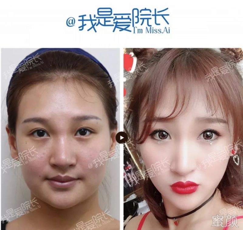 https://img.miyanlife.com/mnt/timg/200316/1343196461-9.jpg