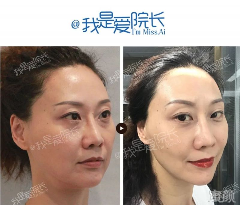 https://img.miyanlife.com/mnt/timg/200316/13431C955-4.jpg