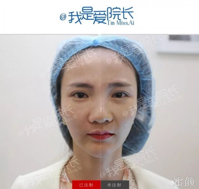 https://img.miyanlife.com/mnt/timg/200316/13431I205-6.jpg