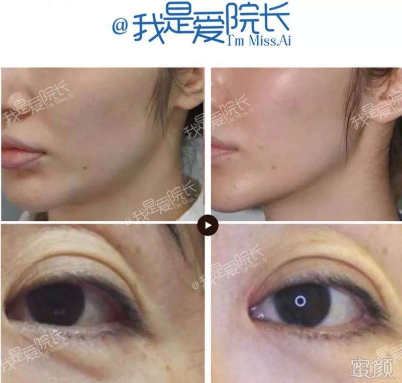 https://img.miyanlife.com/mnt/timg/200316/1343343Z7-13.jpg