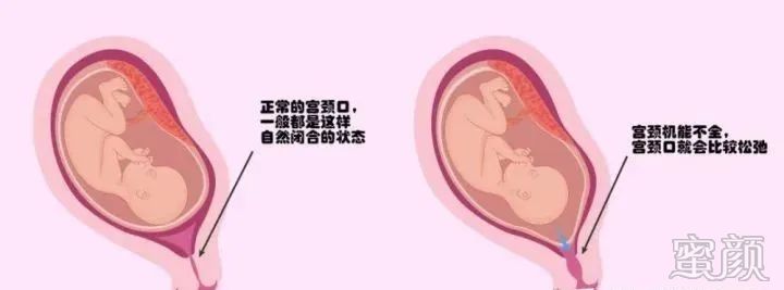 https://img.miyanlife.com/mnt/timg/200317/1319561016-1.jpg