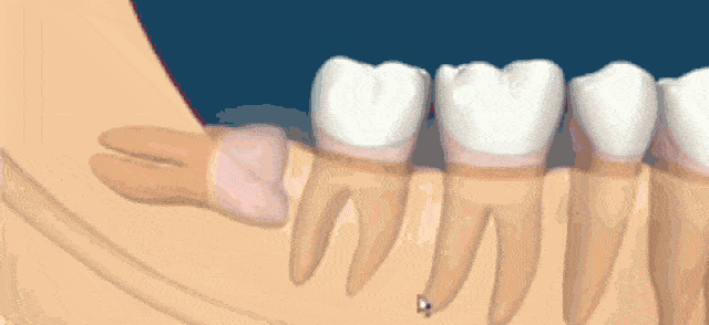 https://img.miyanlife.com/mnt/timg/200317/133F34548-1.gif