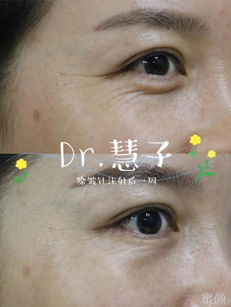 https://img.miyanlife.com/mnt/timg/200317/135155B47-0.jpg