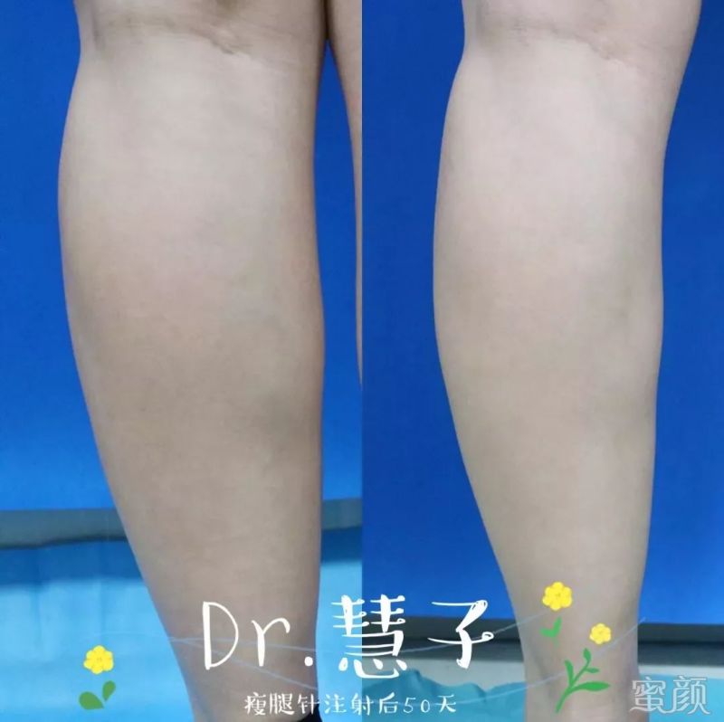 https://img.miyanlife.com/mnt/timg/200317/13521M943-6.jpg