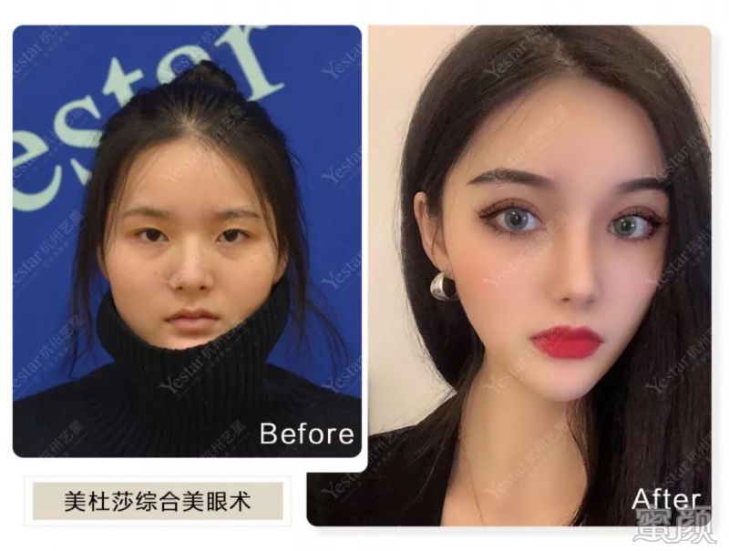 https://img.miyanlife.com/mnt/timg/200317/14060TM7-5.jpg