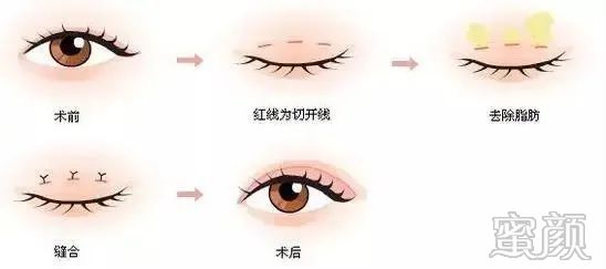 https://img.miyanlife.com/mnt/timg/200317/1412035111-5.jpg