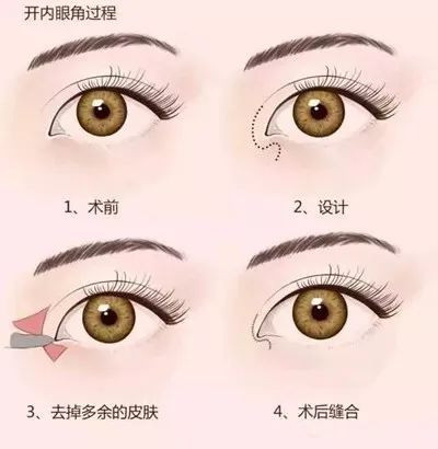 https://img.miyanlife.com/mnt/timg/200317/14120424G-6.jpg