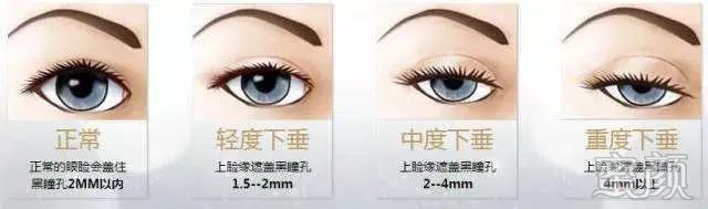 https://img.miyanlife.com/mnt/timg/200317/14120BR8-8.jpg