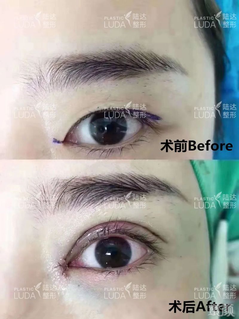 https://img.miyanlife.com/mnt/timg/200317/14120M910-9.jpg