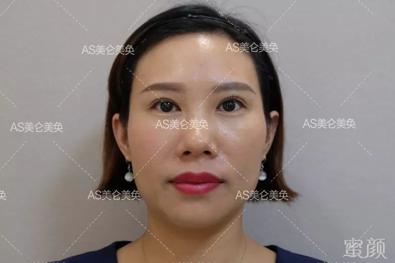 https://img.miyanlife.com/mnt/timg/200318/1226314A6-11.jpg