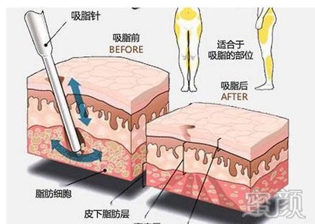 案例图片